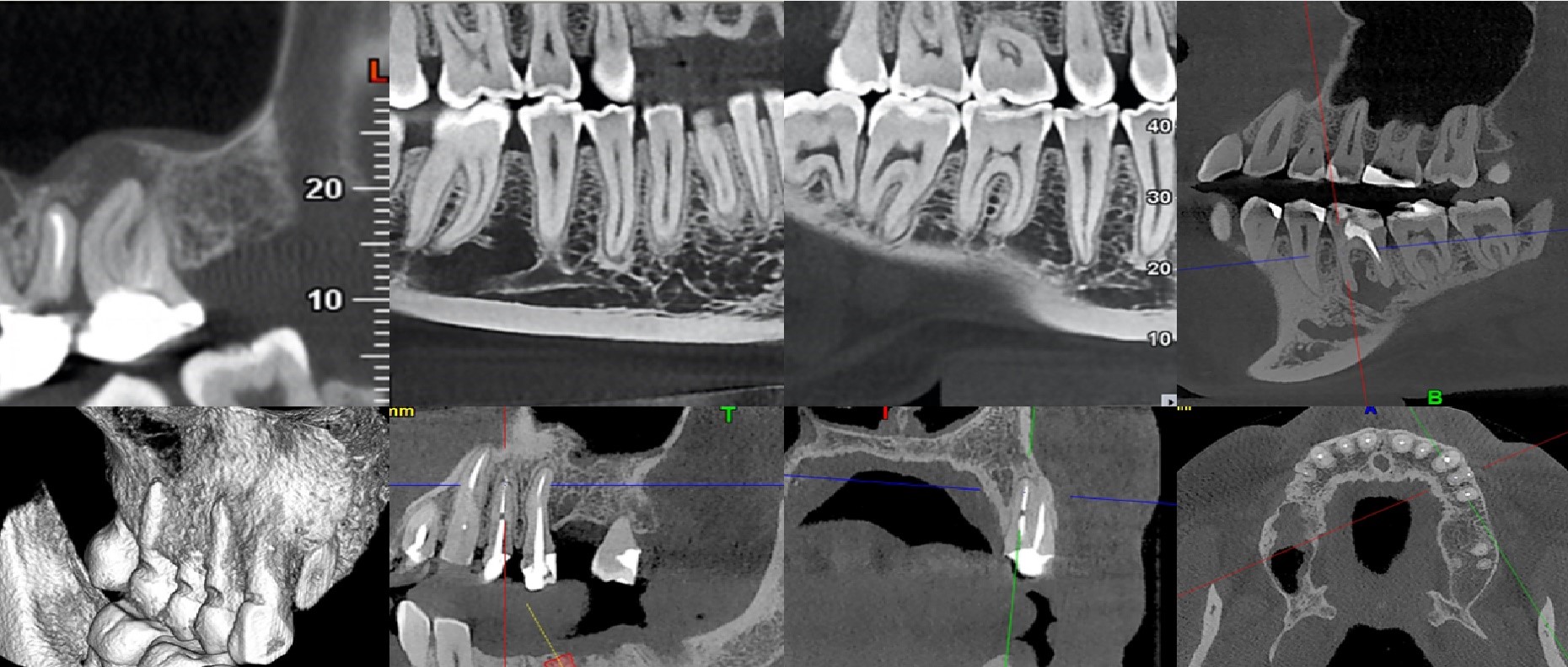 3D CBCT